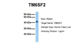 TM6SF2 Rabbit anti-Human, Polyclonal, Novus Biologicals 0.1ml; Unconjugated:Antibodies